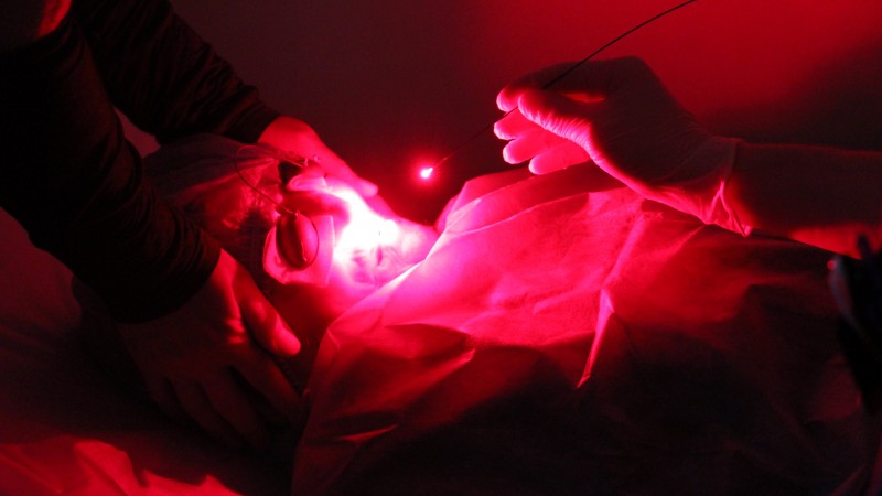 В День открытых дверей лечение фотодинамикой получили все пациенты с диагнозом рак кожи - Файл 3