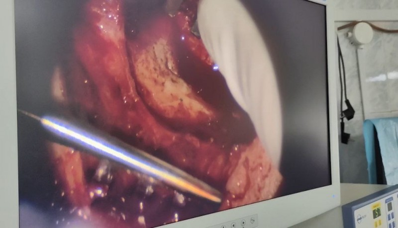 ЛОР-врачи Республиканской клинической больницы Дагестана (https://t.me/rkbrd) вернули слух жительнице Ногайского района - Файл 2