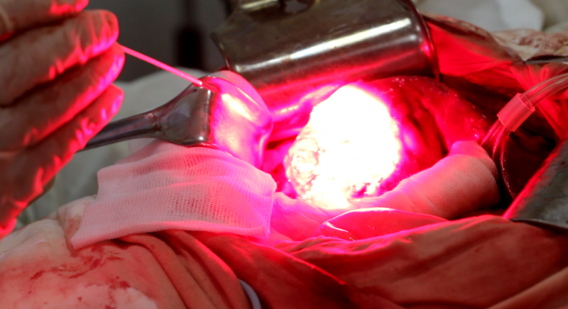 В Республиканской клинической больнице внедрили новейший метод лечения рака - Файл 1