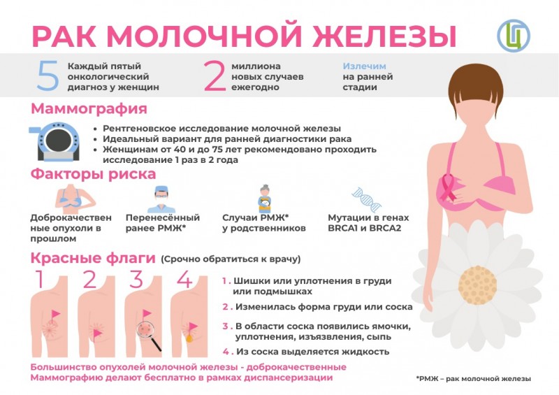 Рак молочной железы - вывить на ранней стадии