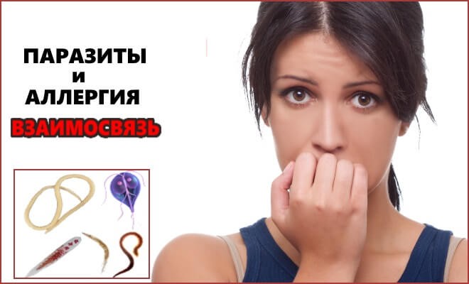 Гельминты, которые могут вызывать аллергические реакции