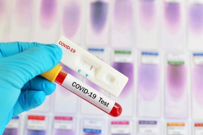 100 тысяч экспресс-тестов на антиген COVID-19 распределены в медучреждения всего Дагестана