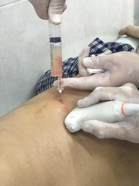 В Гурбукинской участковой больнице внедрили малоинвазивные методы лечения