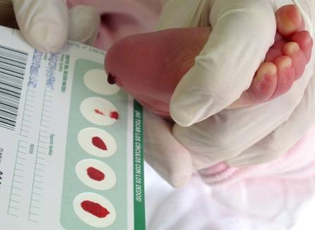 Новорожденных дагестанцев теперь проверяют на 36 сложных генетических патологий